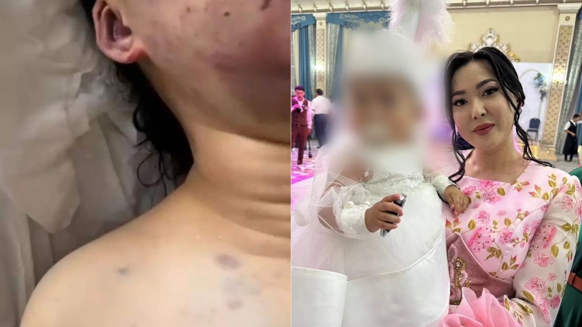 Ұзақ уақыт бойы жыныстық қатынасқа түспедім, шап аймағым ауырады, жазу қиын.